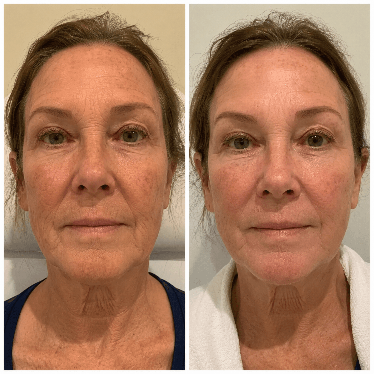 Before and after treatment result