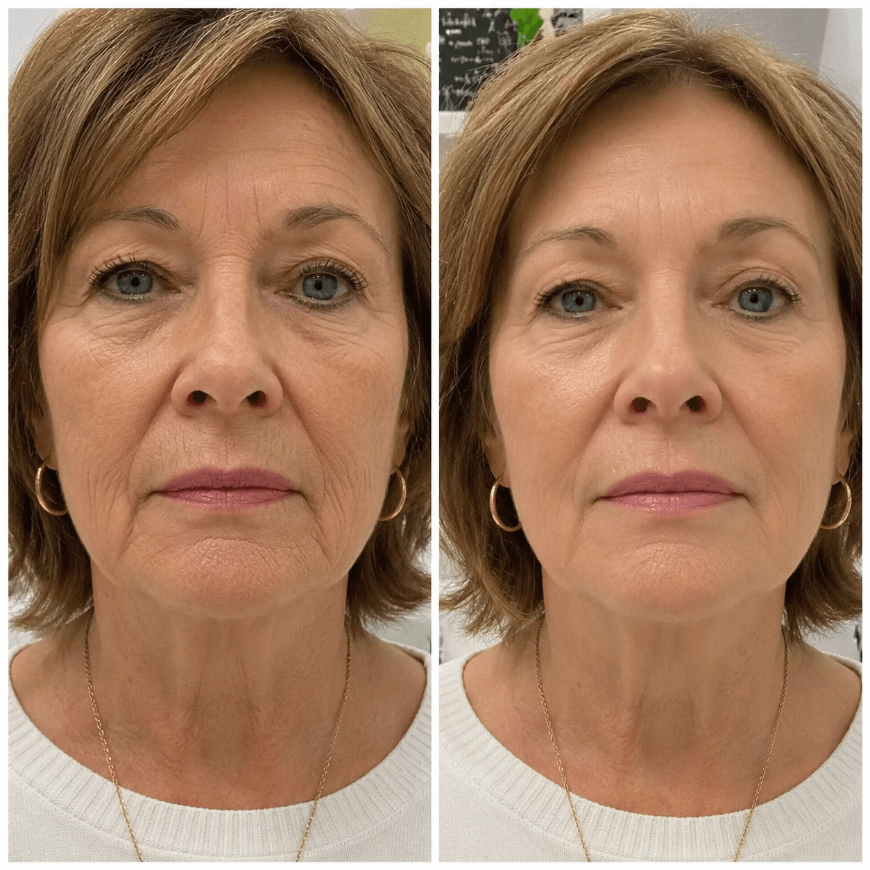 Before and after treatment result